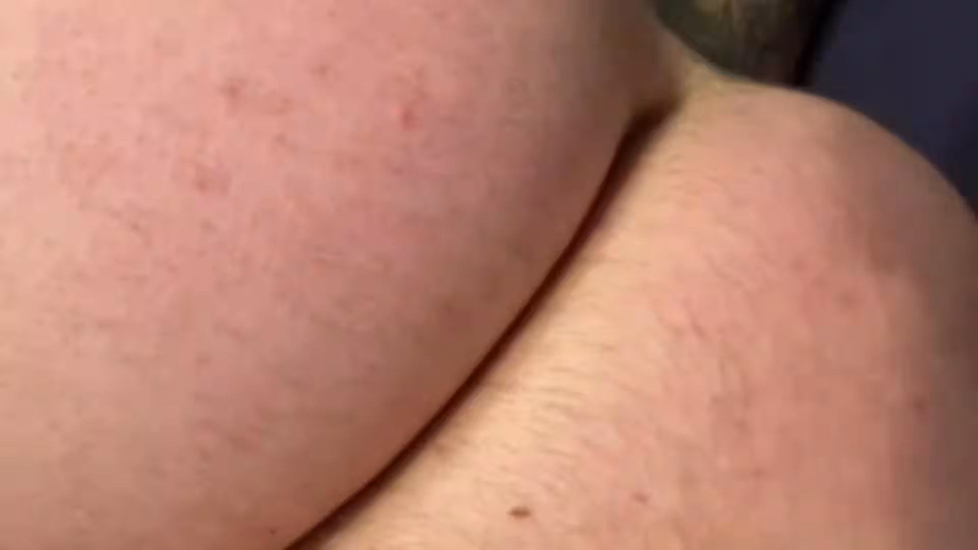 hairy Chris Hatton erome
0